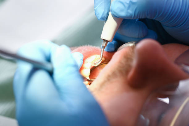 Best Same-Day Emergency Dental Services in Calverton Park, MO