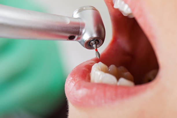 Best Urgent Care for Lost Fillings or Crowns in Calverton Park, MO